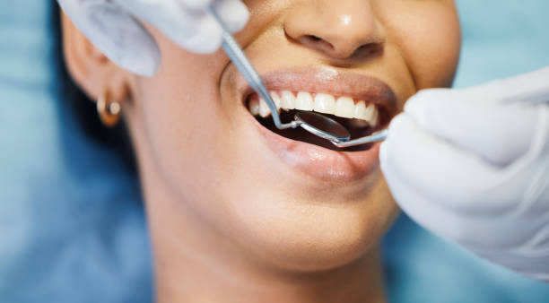Best Emergency Broken Tooth Repair in Rock Rapids, IA